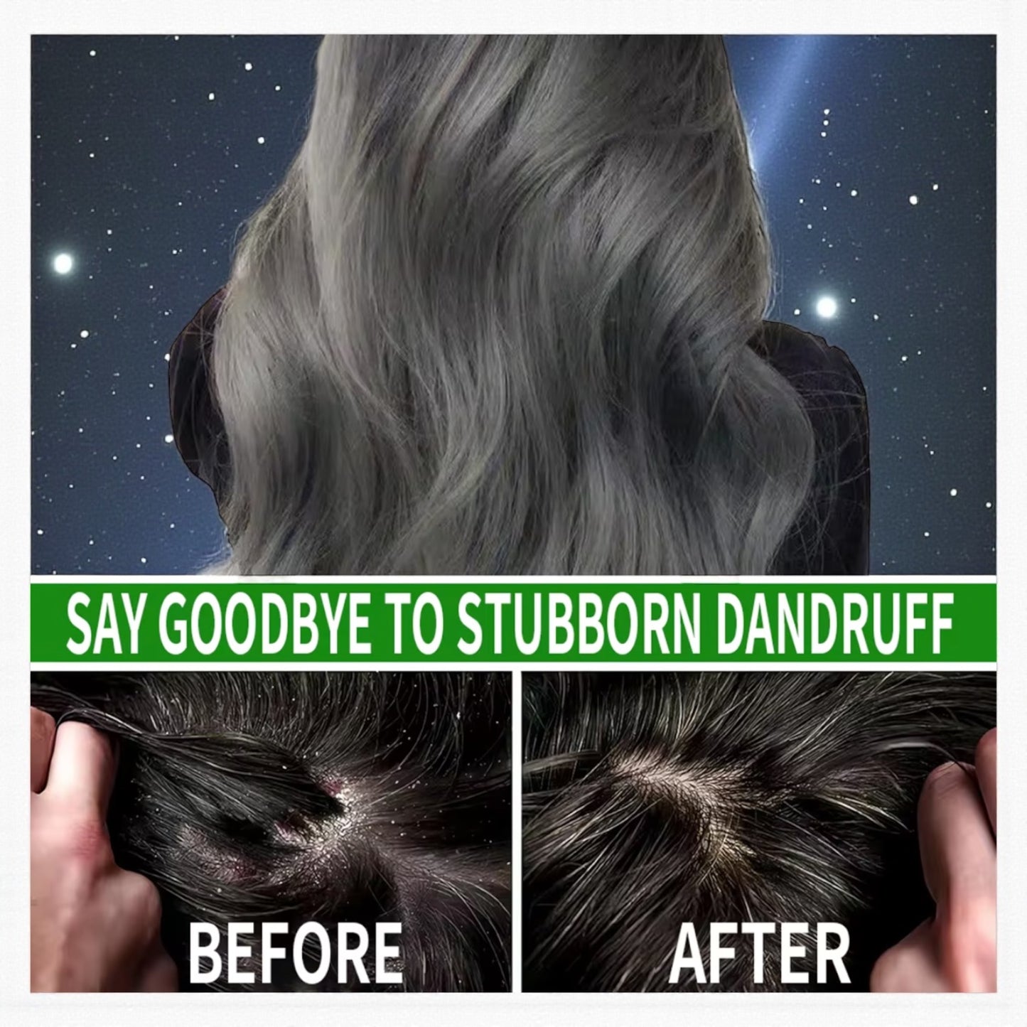 ACEITE DE BOTANA OIL