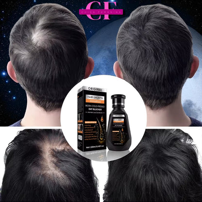 CHAMPÚ PARA EL CRECIMIENTO DEL CABELLO JENGIBRE