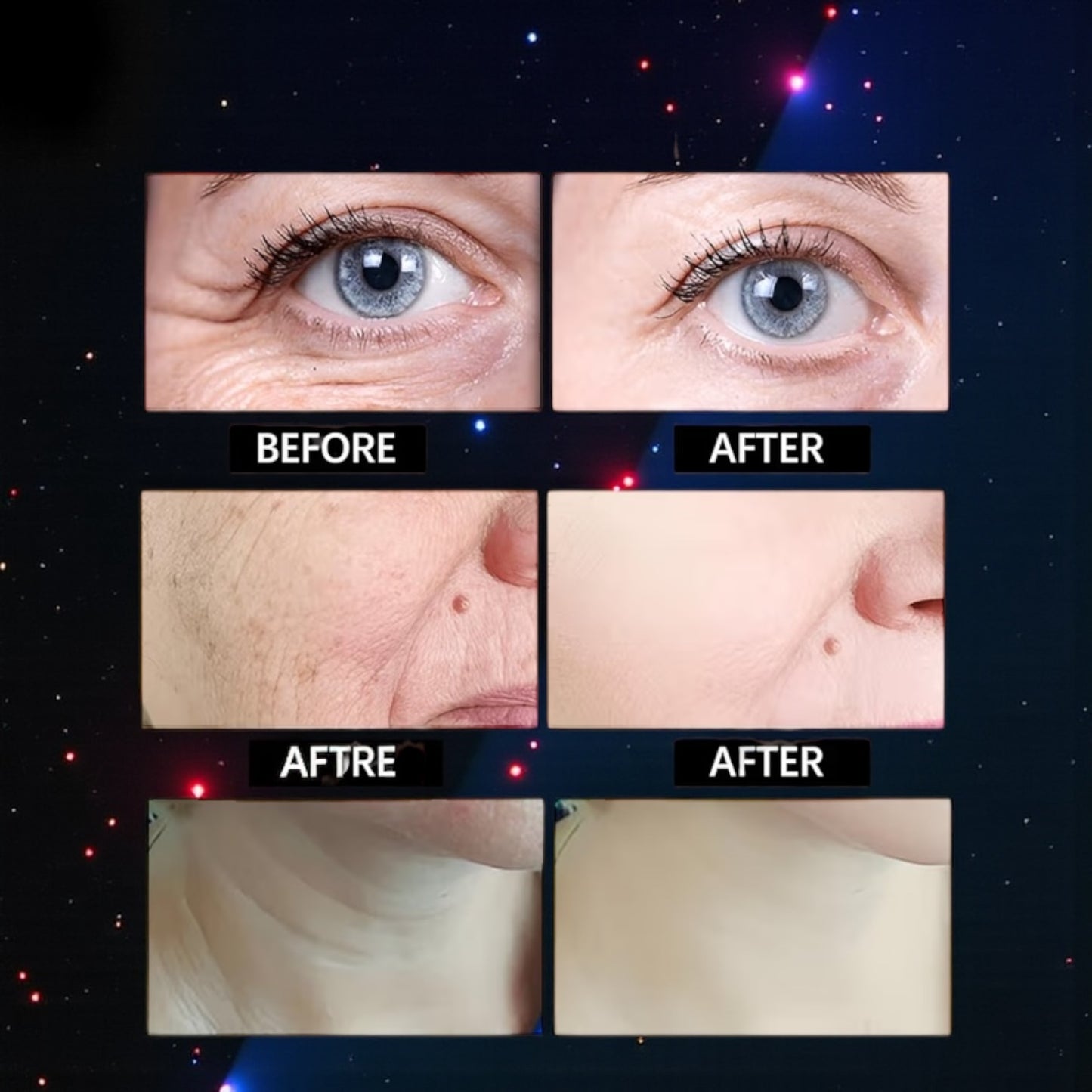 CREMA DE BOTOX VENENO DE ABEJA