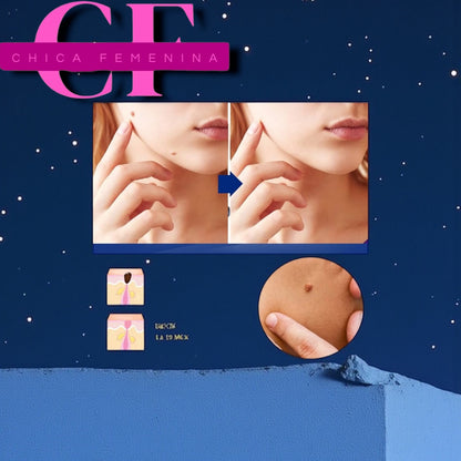 WART REMOVER CINTMENT