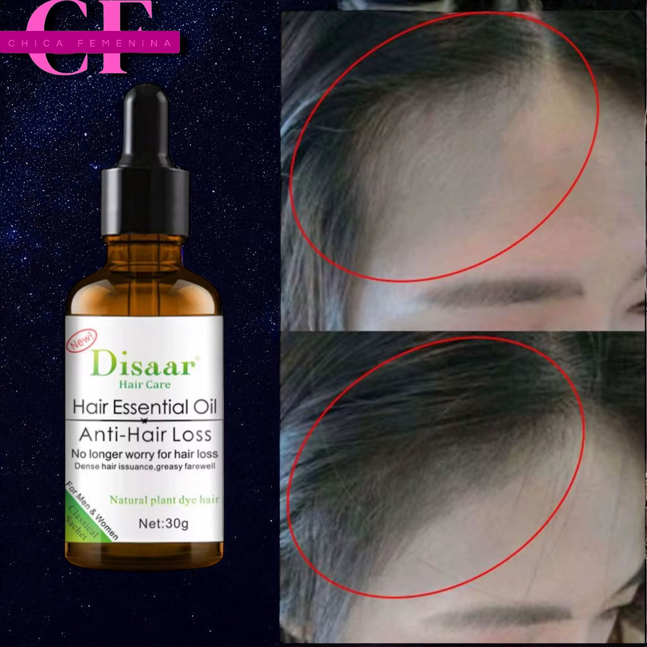 DISAAR SERUM PARA EL CRECIMIENTO DEL CABELLO HOMBRE Y MUJERES