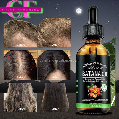 ACEITE DE BOTANA OIL