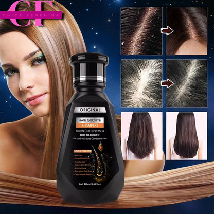 CHAMPÚ PARA EL CRECIMIENTO DEL CABELLO JENGIBRE