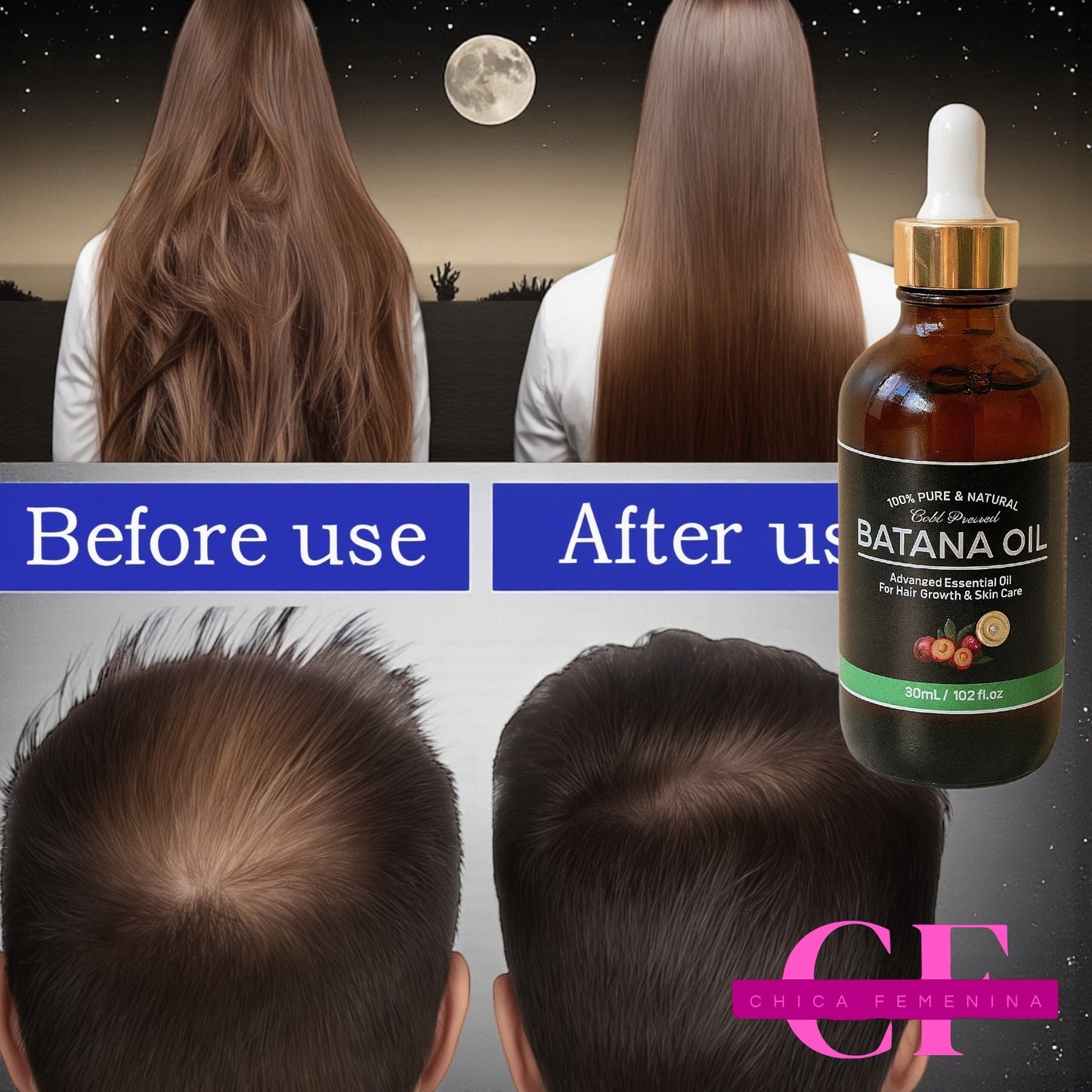 ACEITE DE BOTANA OIL