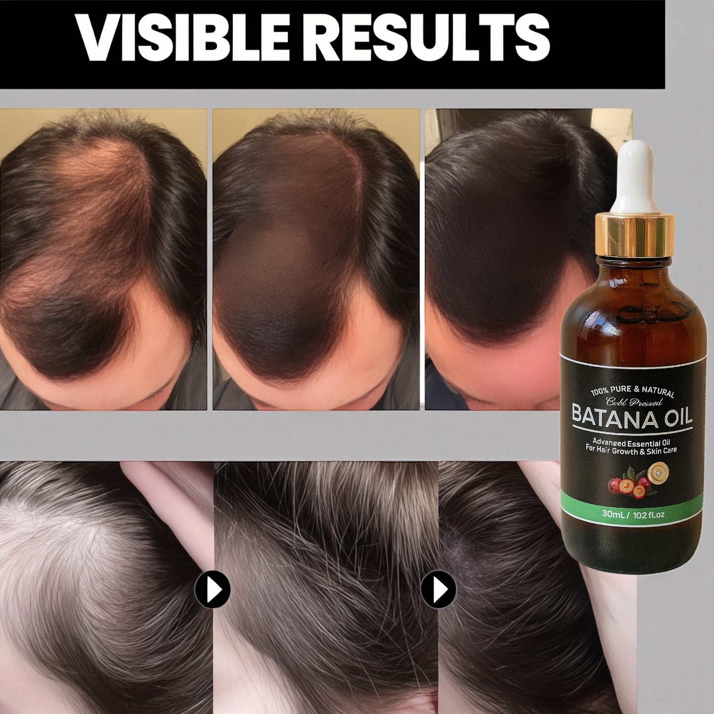 ACEITE DE BOTANA OIL