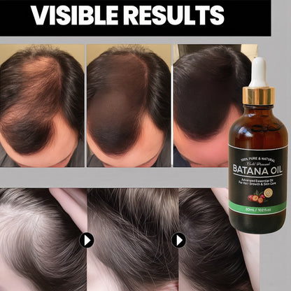 ACEITE DE BOTANA OIL